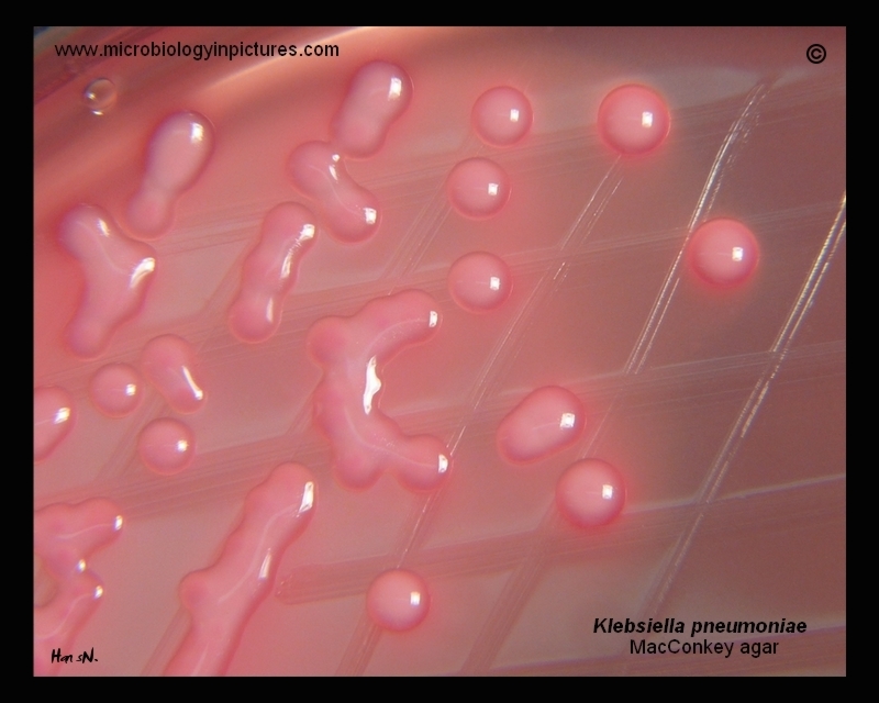 appearance of K.pneumoniae colonies on agar